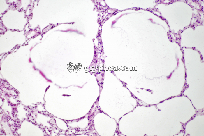 Poumon de Rat montrant les alvéoles x40 - gryphea.org